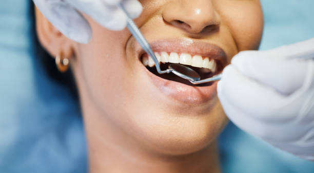Best Pediatric Emergency Dentist in Sheldon, TX